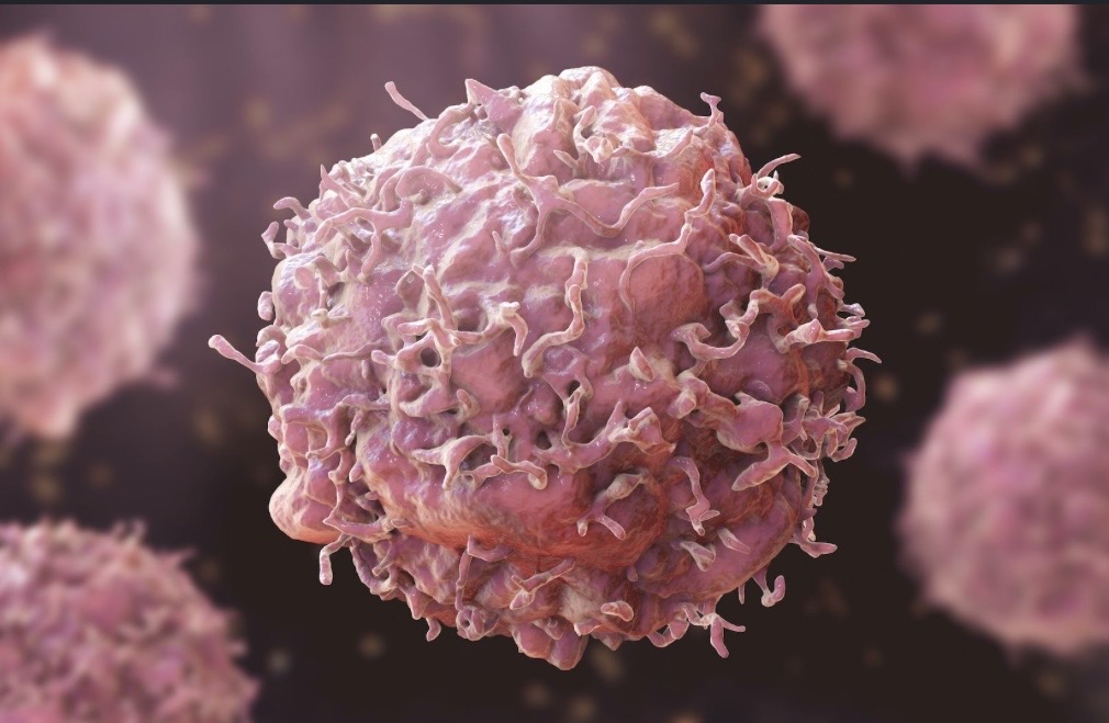 Cover image for Cancer: the silent Epidemic